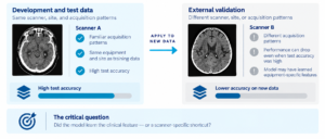 Side-by-side medical scans from two different scanners showing differences in image contrast and texture